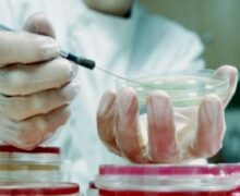 Услуги паразитологической лаборатории