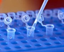 Тест на определение антител IgG и IgM к вирусу SARS-CoV-2 методом ИФА