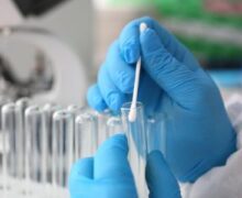 Тест на выявление РНК вируса SARS-CoV-2 в мазке со слизистой и носоглотки методом ПЦР